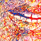 Ursus - Bild 301: Pero Me Quedé Dormida; Detail